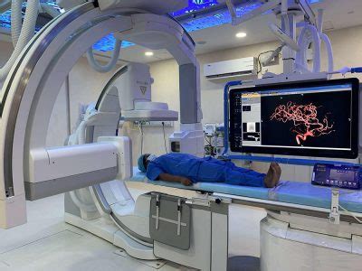 interventional radiology near union city|25 of the Best Interventional Radiologists near Union City, GA.